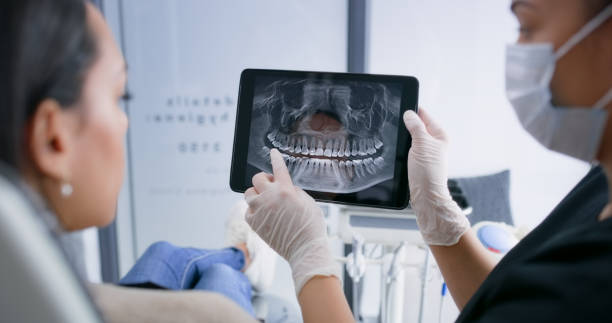 Licensed Tooth Extraction service in Madison, GA - Smile Center Dentistry